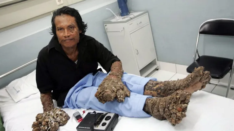 Preminuo čovjek drvo