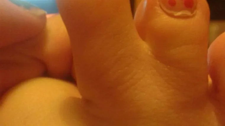 Poludjela kada je na internetu nai&scaron;la na fotografije svojih stopala