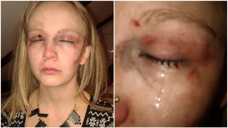 "Pomozite, državi je ovo lak&scaron;a ozljeda, a on je slobodan!"