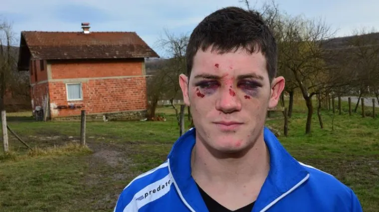 Mladi Jovan nije pretučen zato &scaron;to je Srbin