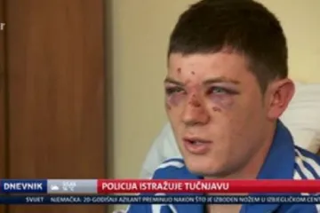 'Udarali su me i vikali: 'Nije ti ovo Srbija!''