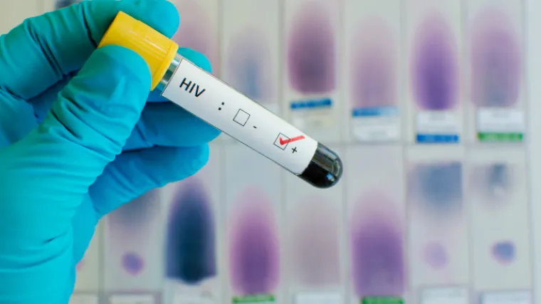 Uspje&scaron;no testirali genetsko liječenje zaraze HIV-om