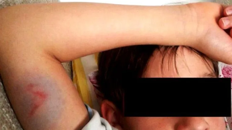 Sigurnosna vrata banke ozlijedila 8-godi&scaron;njeg dječaka!