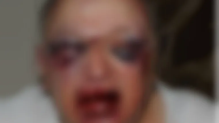 Policija objavila fotografije starca kojeg su brutalno pretukli pljačka&scaron;i