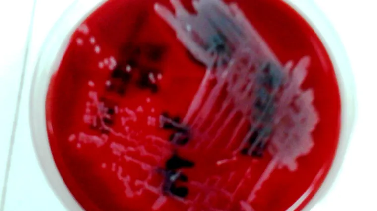 Znanstvenici tvrde da su pronašli način kako ubiti superbakteriju