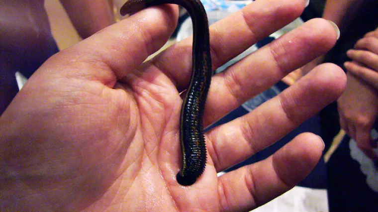 U vaginu stavljala pijavice da bi ostala u drugom stanju