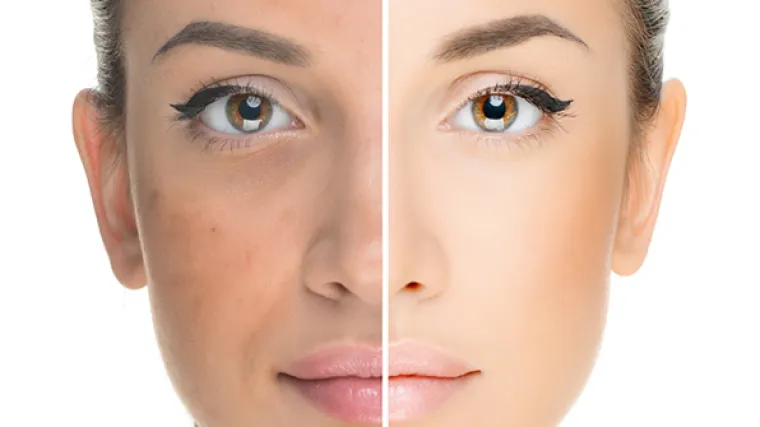 Male tajne poznatih dermatologa koje će vam nerado reći