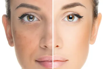 Male tajne poznatih dermatologa koje će vam nerado reći