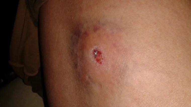 Zračnicom ubio dva kućna ljubimca, puca i po ljudima