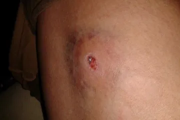 Zračnicom ubio dva kućna ljubimca, puca i po ljudima