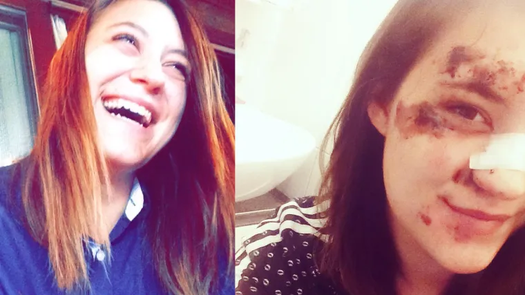 Kaže da ju je netko 'samo o&scaron;amario'