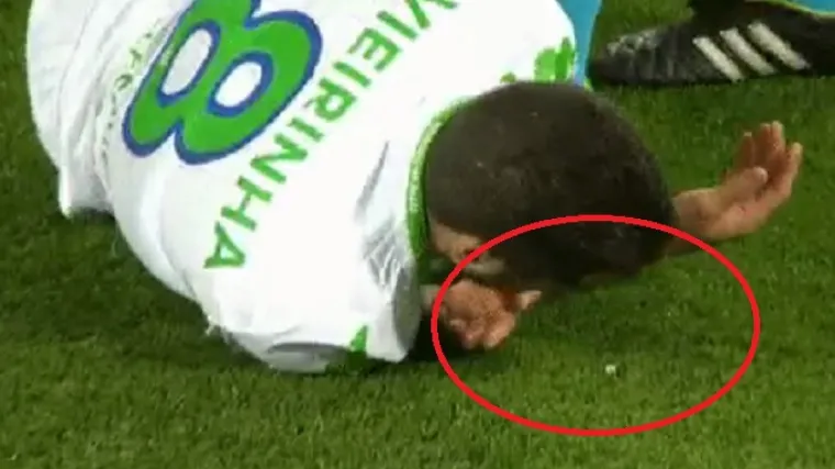 Pogledajte kako je portugalski reprezentativac ostao bez zuba