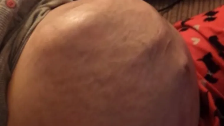 Beba toliko aktivna u maminom trbuhu da se jasno vide ručice, nogice...