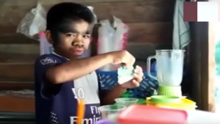 Sretan je jer misli da je njegov poremećaj dar od Boga