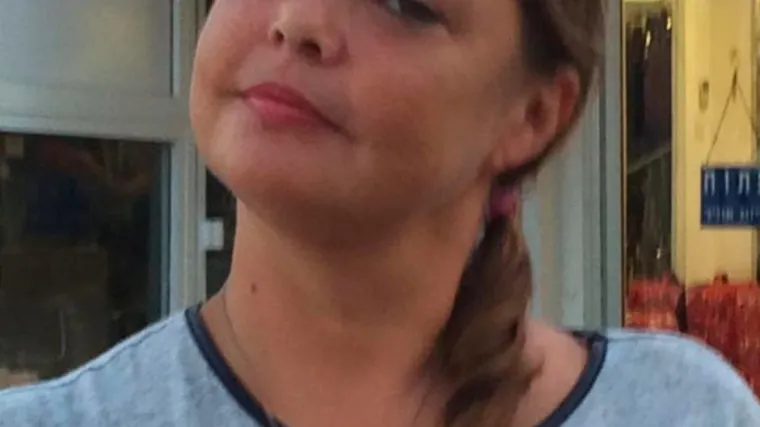 Djevojka puna modrica, patolozi tvrde da je umrla prirodnom smrću