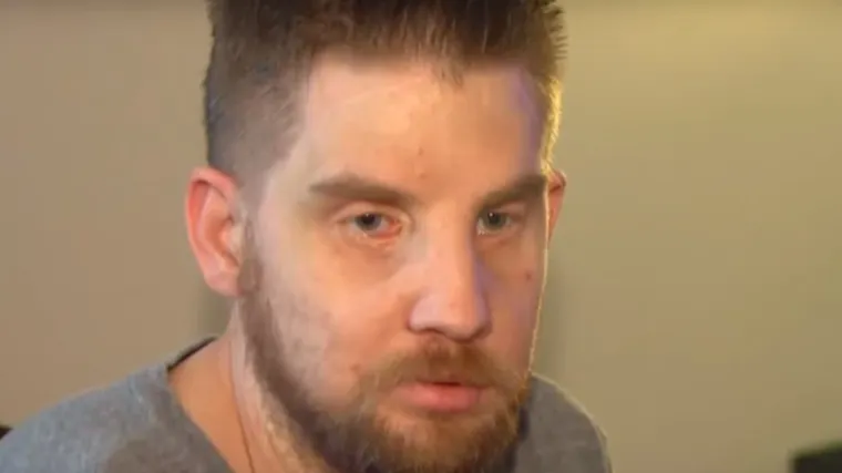 Ovako izgleda život čovjeka kojem su presadili cijelo lice