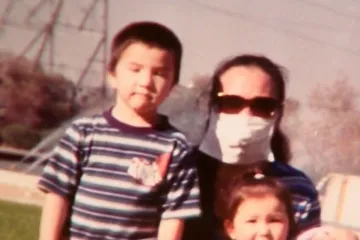 Muž ju je tako pretukao da je godinama nosila masku