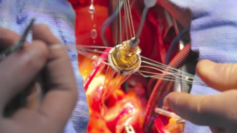 Tijekom 1960-ih pokušali su napraviti umjetno srce pokretano radioaktivnim materijalom