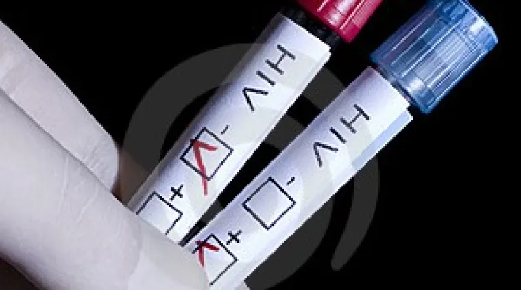 Znanstvenici izbrisali HIV iz živog tkiva laboratorijskih životinja