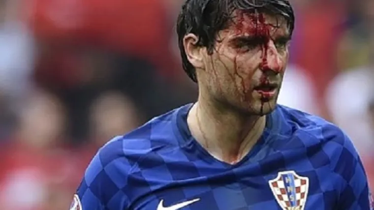 Liječnik reprezentacije otkrio hoće li Ćorluka biti spreman za Čehe