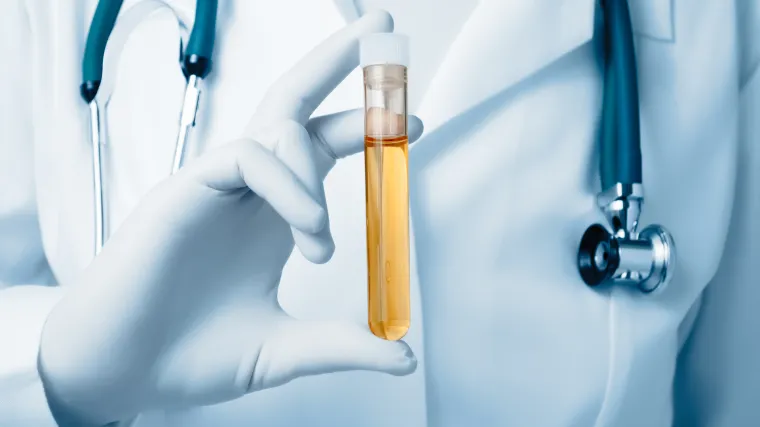 Ove vrste raka kod mu&scaron;karaca mogu se otkriti vrlo rano