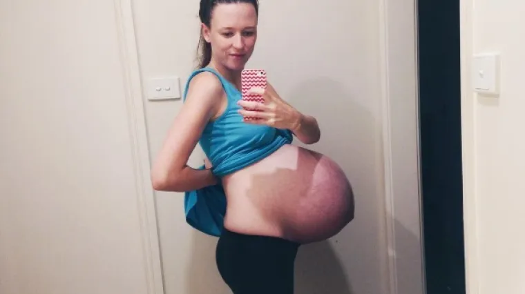 Njezina stara trudnička fotografija zavr&scaron;ila na porno stranici