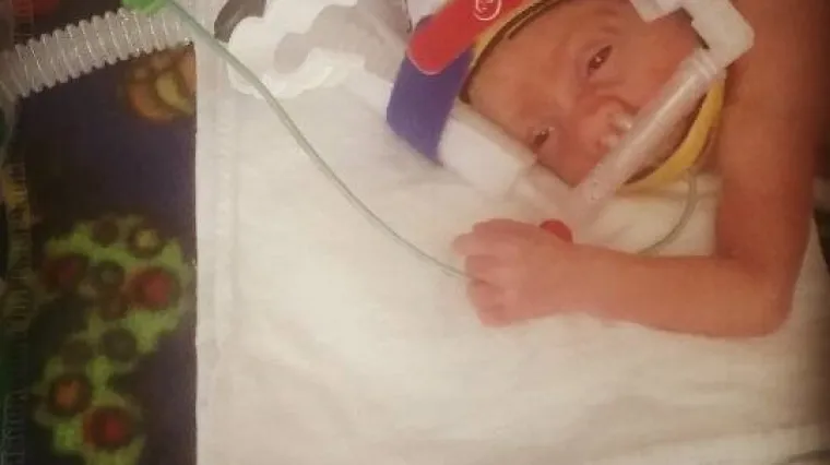 Dječačić rođen tako sitan da je živio u vrećici za pečenje