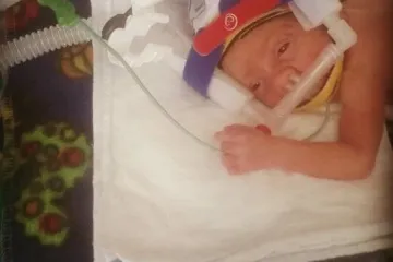 Dječačić rođen tako sitan da je živio u vrećici za pečenje