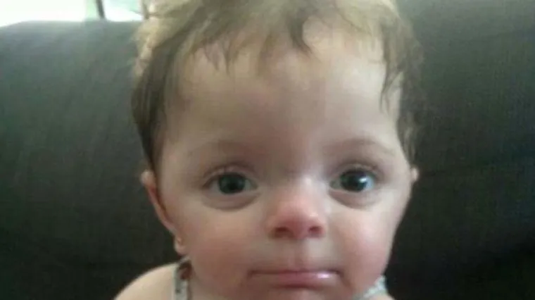 Od milja je zovu 'Palčica': upoznajte najmanju djevojčicu na svijetu