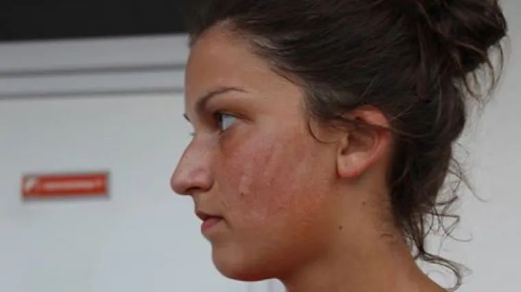 Skandal u Srbiji: o&scaron;amario nogometa&scaron;icu Zvezde jer je slavila pobjedu nad njegovim klubom?!