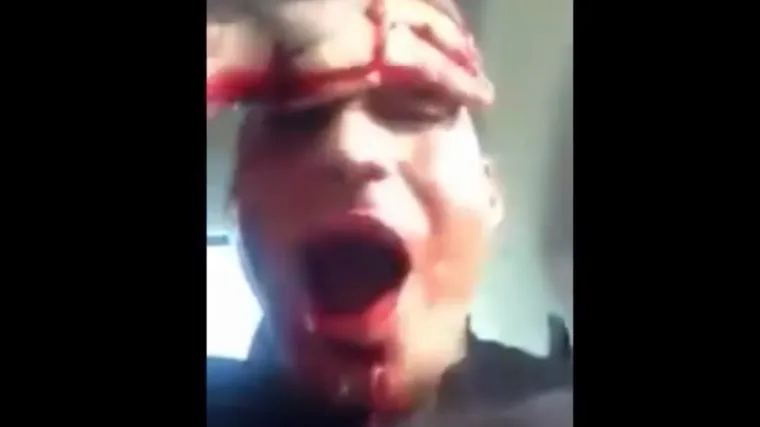 Upucao se u lice zbog malo slave na dru&scaron;tvenim medijima