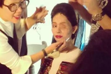 19-godišnja žrtva napada kiselinom prošetala pistom NY Fashion Weeka