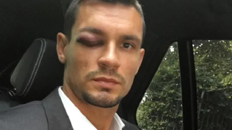 Evo za&scaron;to Lovren ne igra utakmicu protiv engleskih prvaka