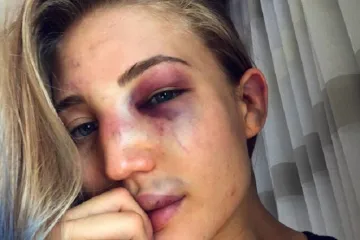 Jedna od najljep&scaron;ih sporta&scaron;ica svijeta &scaron;okirala fotografijom nakon borbe