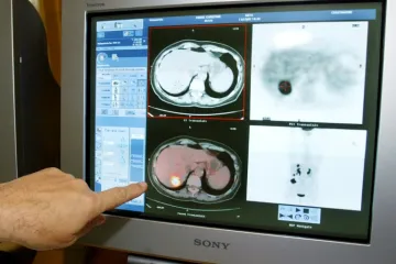 U Microsoftu tvrde da imaju rješenje za izlječenje raka!