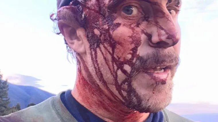 Nesretni mu&scaron;karac sve snimio i objavio na Facebooku, a potom se sam odvezao u bolnicu