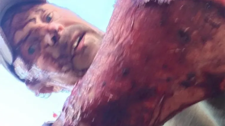 Kakav Leonardo DiCaprio: ovaj čovjek preživio je dva napada medvjeda u 10 minuta pa objavio video sav u krvi