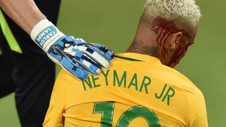 'Pona&scaron;ao se previ&scaron;e bahato'