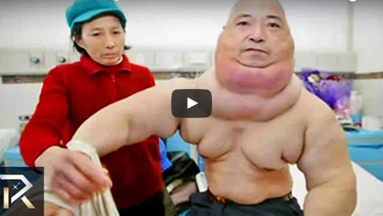 Nevjerojatne operacije koje su izveli pravi pravcati čarobnjaci