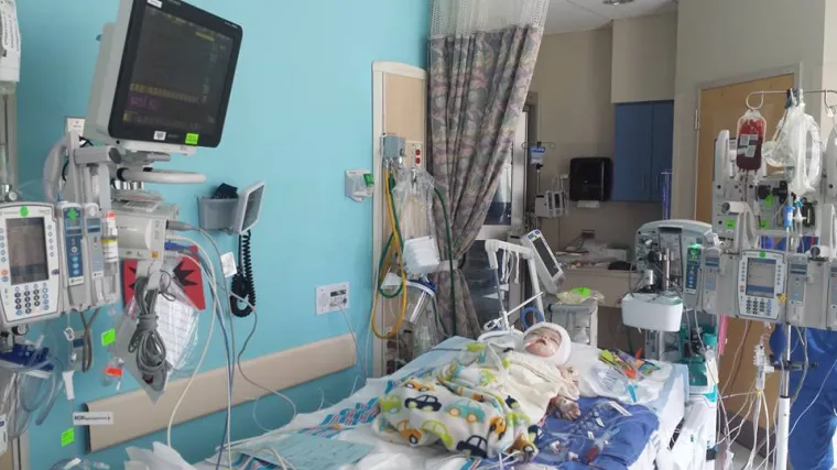 Sijamski blizanci spojenih glava uspje&scaron;no su razdvojeni nakon 27-satne operacije