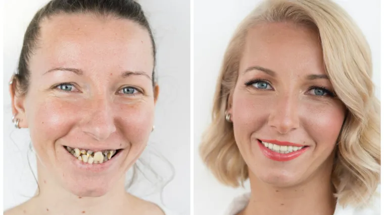 Humanitarni makeover  u &Scaron;timac centru dentalne medicine