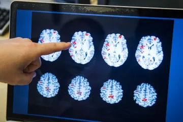 Magnetna rezonanca otkriva laganje preciznije od poligrafa