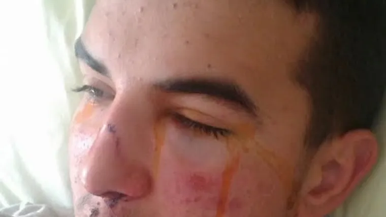 Mladića na&scaron;li u lokvi krvi...