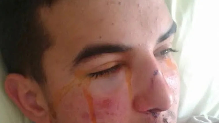 'Pretukli su ga sinovi tajkuna, a policija to zata&scaron;kava. Tražimo ostavke!'