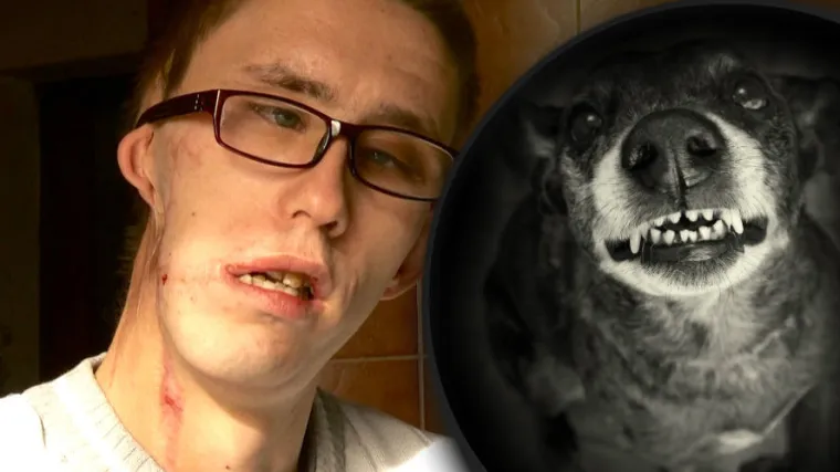 'Trgao je sve sa mene... Doktori su se zgražali i čudili kako sam uopće preživio'