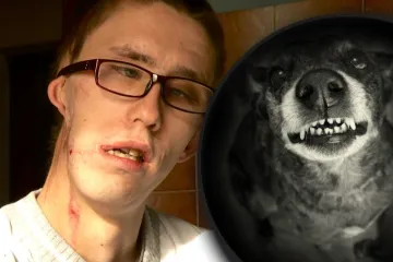 'Trgao je sve sa mene... Doktori su se zgražali i čudili kako sam uopće preživio'