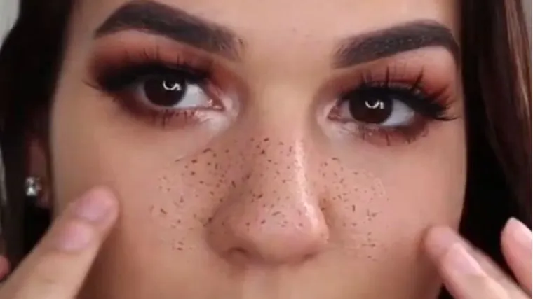 &Scaron;minkerice poludjele za novim trendom: lijepe umjetne pjegice po licu!