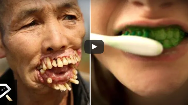 Mislili su da radijacija liječi pa su sve ozračili