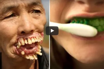 Mislili su da radijacija liječi pa su sve ozračili