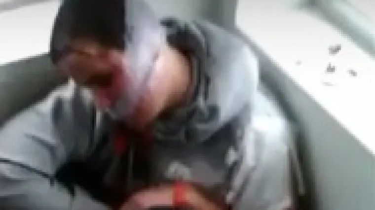 Otetog mladića s posebnim potrebama tukli, rezali nožem i sve prenosili na Facebooku